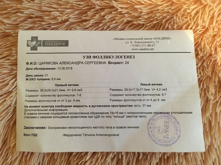 Фолликулометрия 21 д.ц.