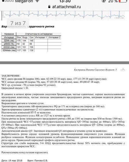 Дисфункция синусового уза или слабость синусового узла у ребёнка