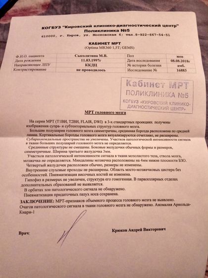 Аномалия Арнольда Киари 1 типа