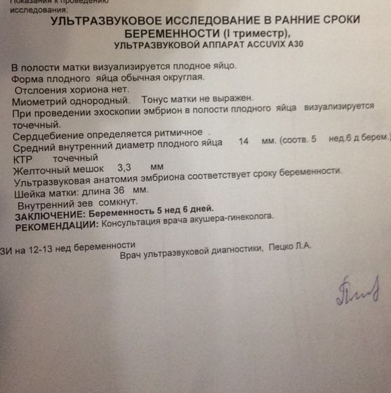 Сделала узи