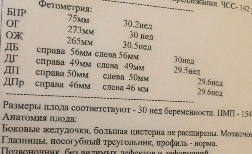 УЗИ