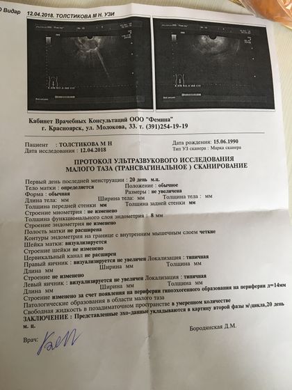 20 день цикла