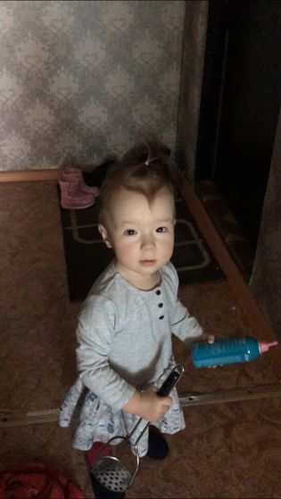 Косоглазие?