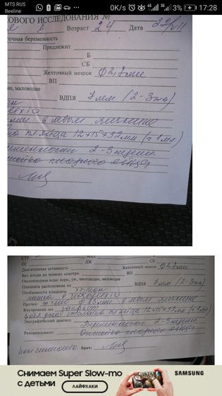 Отслойка плодного яйца?