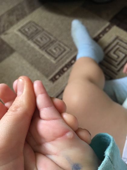 На ладони маленькая шишка