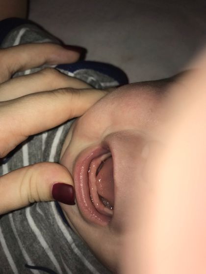 Зубы