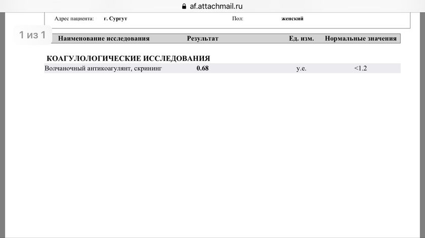 АФС
