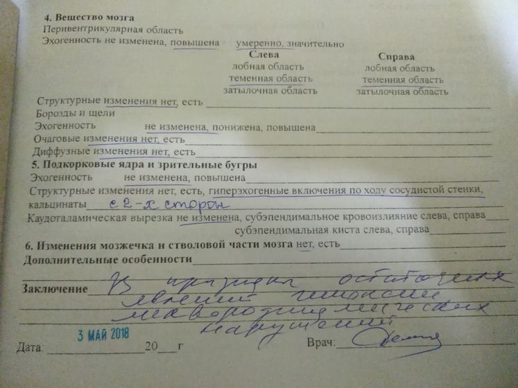 Расширение межполушарной щели и большой цистерны