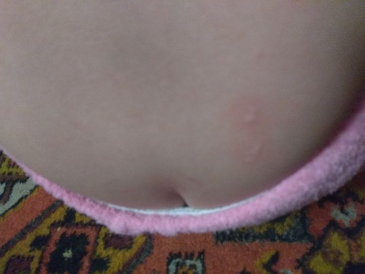 Пятна появляются и исчезают