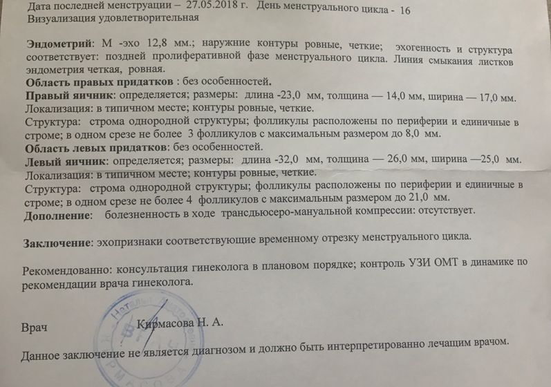 Вот такие узи я люблююю😋