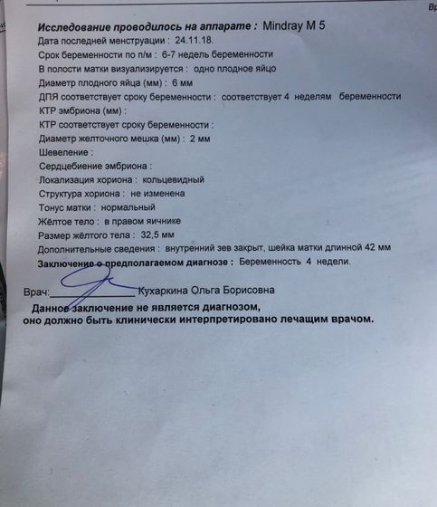 Узи