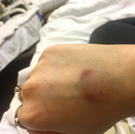 Как берут кровь у нас в больнице