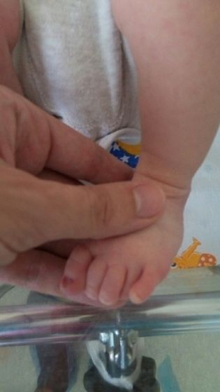 Пальчик ножке заходит за другие