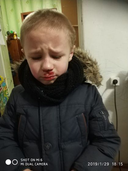 Избили старшего