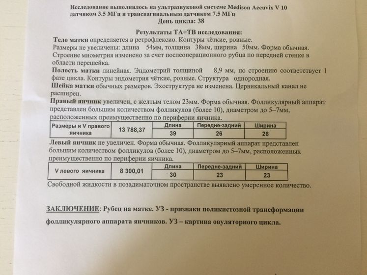 Была Овулюшка 💃💃💃