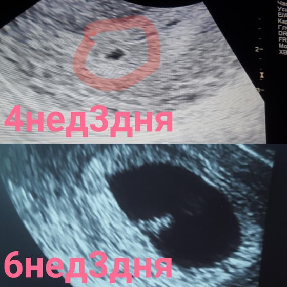 Прошло ровно две недели