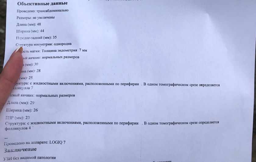 Месячные в середине цикла!