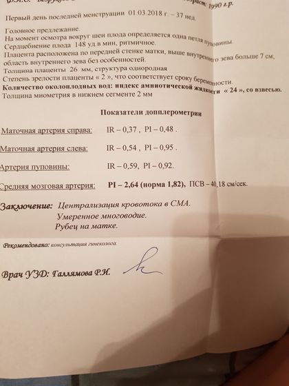 Доплер.Многоводие.