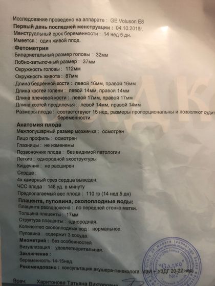 шевеления, 3d узи и новости 15-16 недели