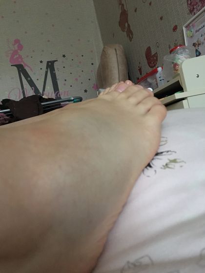 SOS!!!!! Ушиб