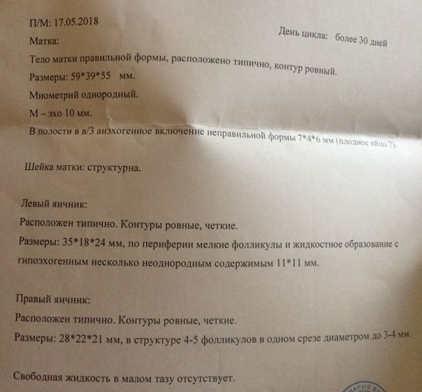 Узи