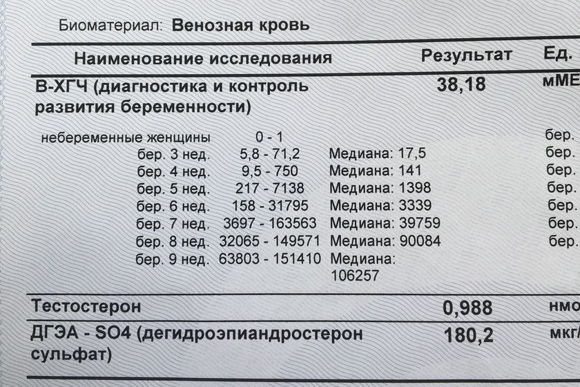 Кто разбирается?
