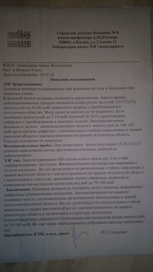 Эпиактивность, пвл