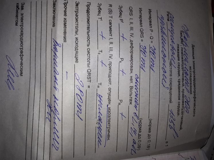 SOS! Помогите расшифровать ЭКГ.. врач напугала..