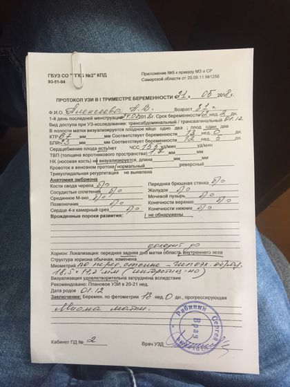 Сходила на УЗИ - рассказываю как и обещала