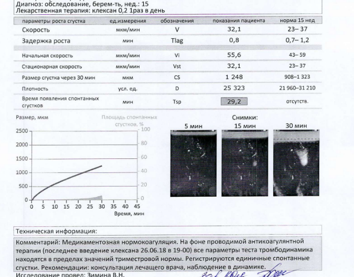 Тромбодинамика