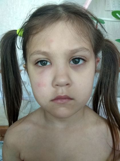 Дочку посукали или комары