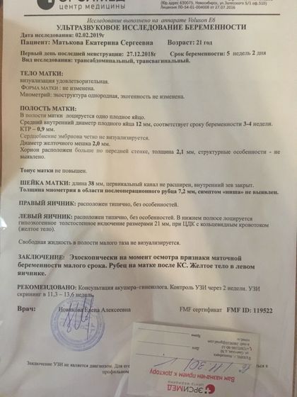 УЗИ