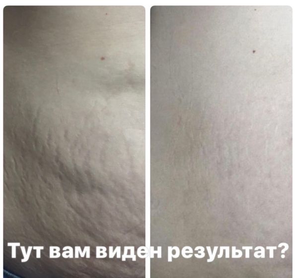 Благополучно удалила это приложение