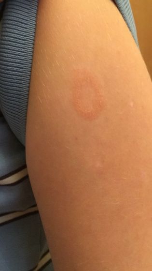 Help....посмотрите фотки,может,у кого-то было подобное?