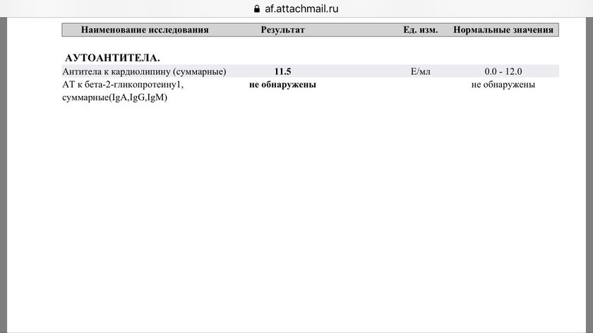 Вот и результаты мои пришли