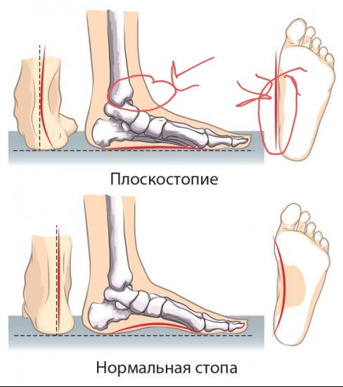 "Zumba" и обувь