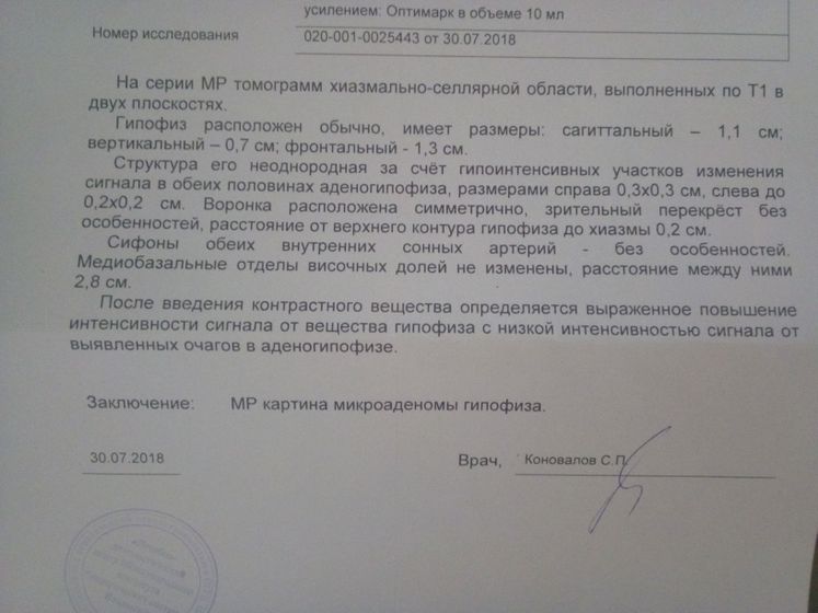 Микроаденома гипофиза