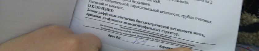 ЭЭГ