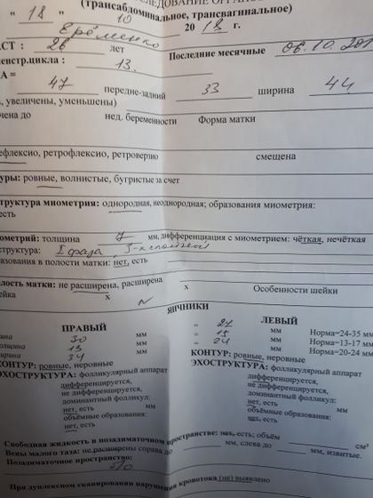 Мое УЗИ на 13 дц
