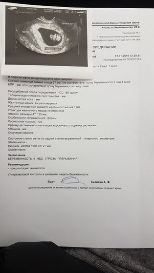 Узи