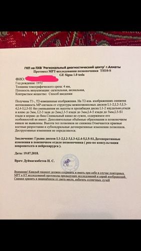 Грыжи мезпозвоночные