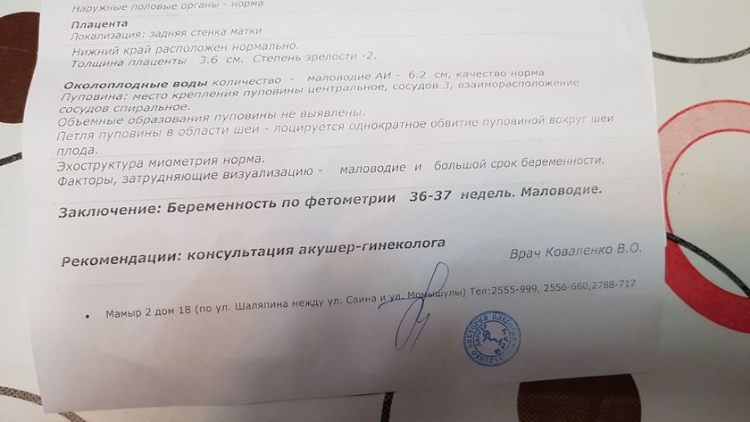 У кого было маловодие и обвитие вокруг шеи?
