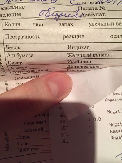 Анализ мочи расшифруйте пожалуйста