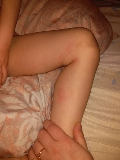На что похоже пятна?