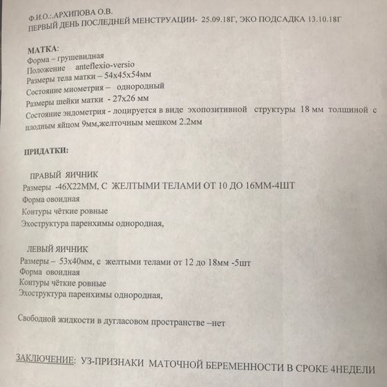 Узи