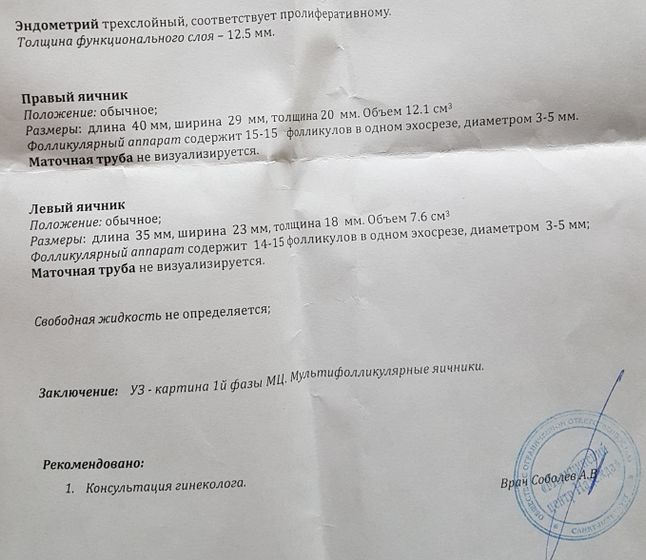 Узи