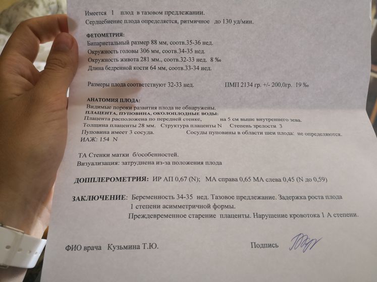 Сзрп 1й степени