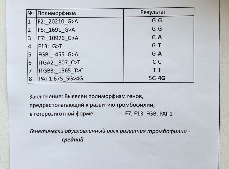Планирование после 2 ЗБ