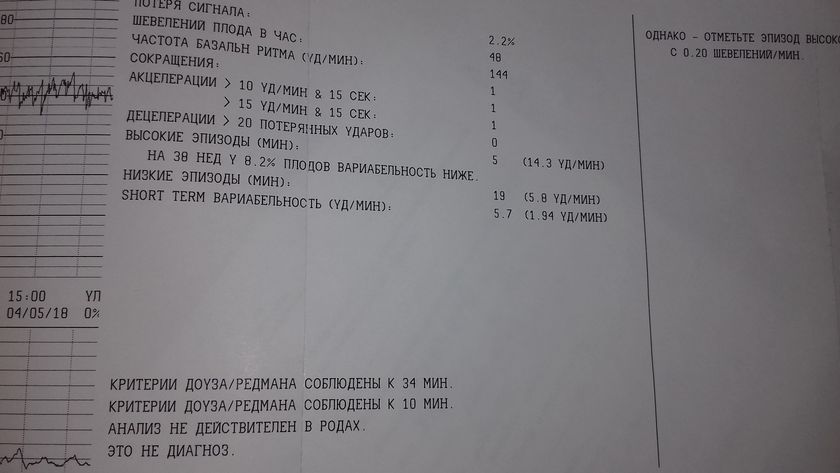 Всем привет КТГ в роддоме .