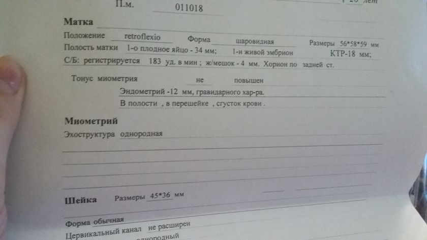 По узи угроза ((((